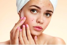 ΦΡΟΝΤΙΔΑ ΤΗΣ ΑΚΜΗΣ