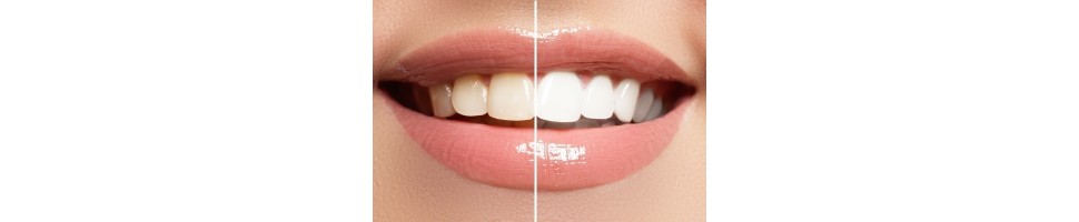 ΛΕΥΚΑΝΤΙΚΑ ΔΟΝΤΙΩΝ