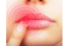 ΕΠΙΧΕΙΛΙΟΣ ΕΡΠΗΣ