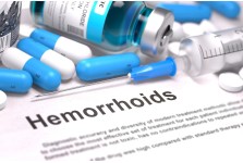 ΑΙΜΟΡΡΟΪΔΕΣ